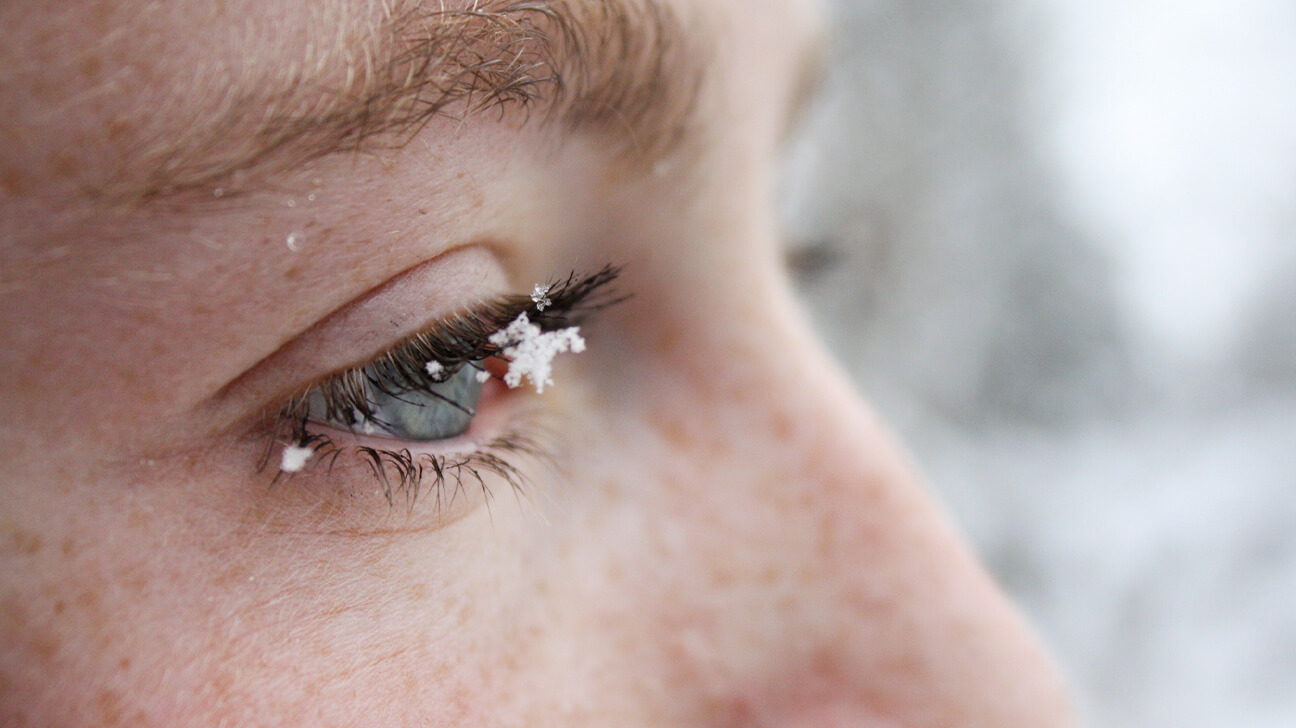 Treating (and Preventing) Dry Eyes in Winter